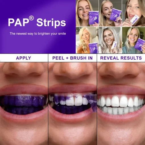 Flysmusยฎ Whitening Strips