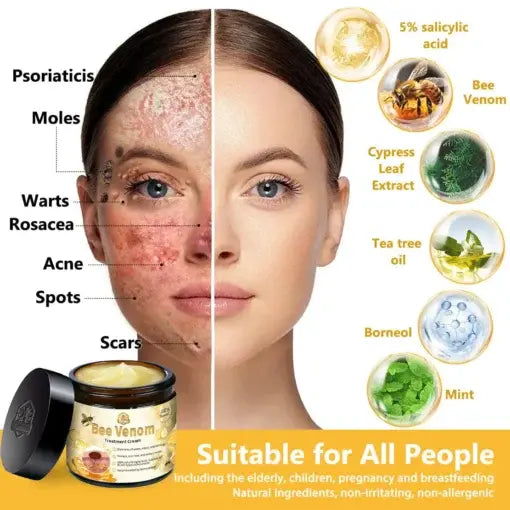 TLOPA® Bee Venom Skin Treatment Cream