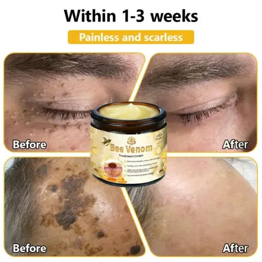 TLOPA® Bee Venom Skin Treatment Cream
